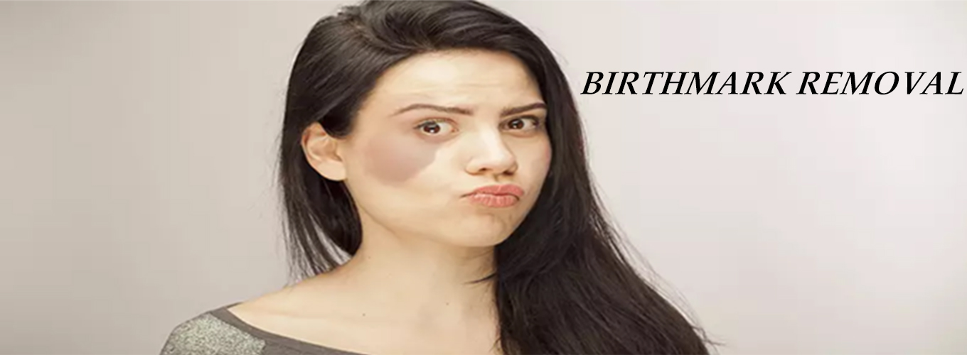 BIRTHMARK-REMOVAL-8 BIRTHMARK-REMOVAL-8